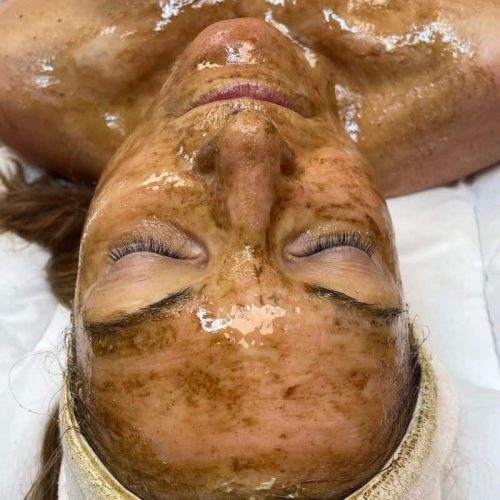 Facial Treatments in Scotts Township, PA and Mt Lebanon, PA - Skin Boutique