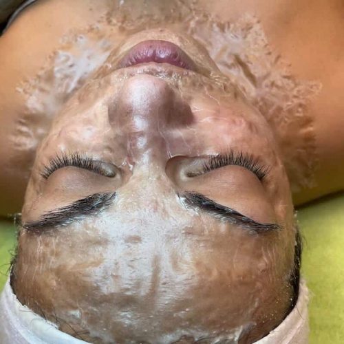 Skin Care Spa With Rosacea Facial Treatment in Pittsburgh, PA - Skin Boutique