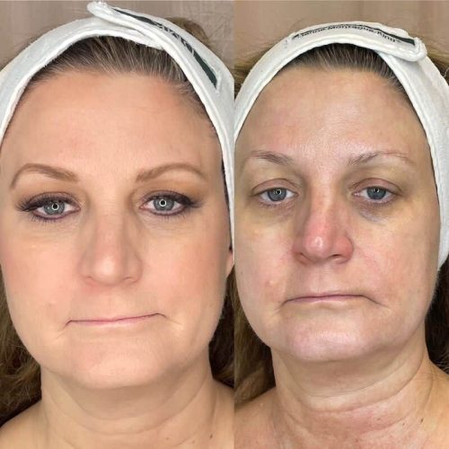 Special Event, Natural Makeup Artist in Pittsburgh, PA - Skin Boutique - Before & After
